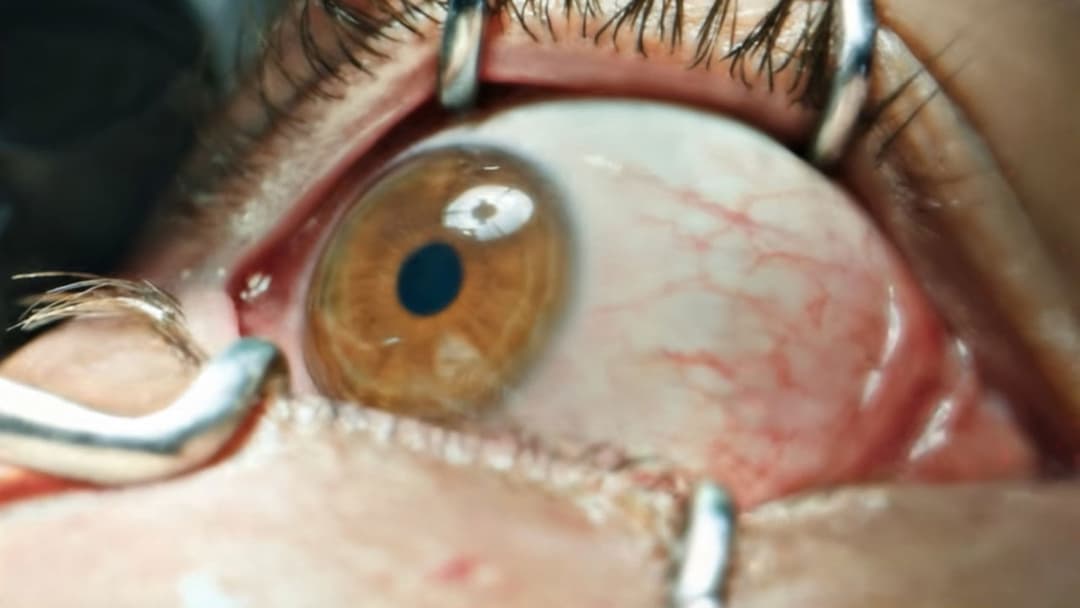 Наглядач backdrop 8